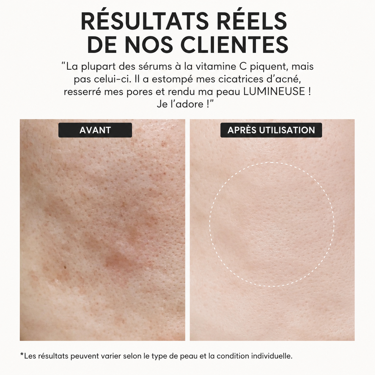 Arencia Potent Vitamin C Shot for Radiant, Even-Toned Skin